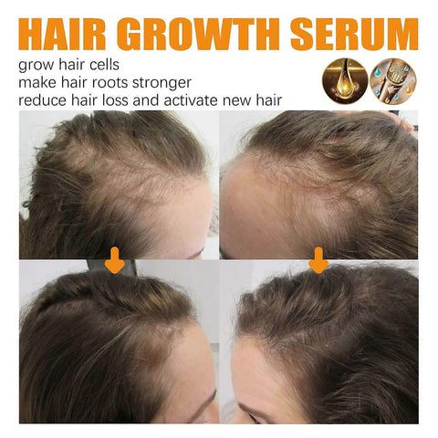 Hair Growth Essential Oil