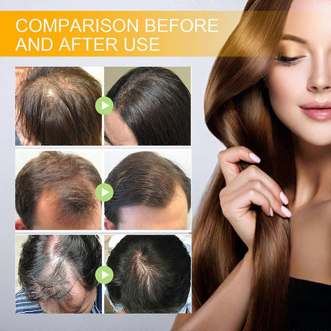 Hair Growth Essential Oil
